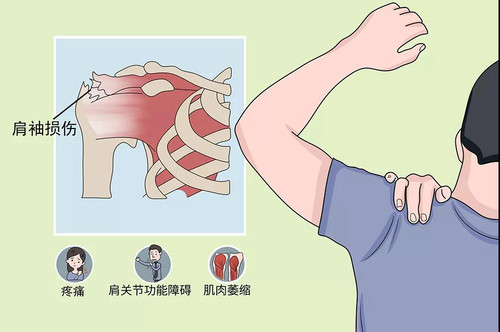 R-C，肩袖損傷