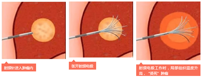 圖片 5.png